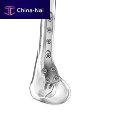 Femoral osteotomy plate distallockingtitanium
