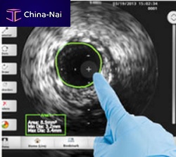 Intravascular ultrasound imaging software COREanalysis