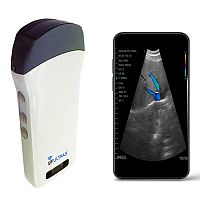 Hand-held ultrasound system SIFULTRAS-3.3for cardiovascular ultrasound imagingB/Wcolor doppler