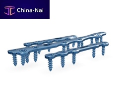 Tarso-metatarsal joint arthrodesis plate 26.26 serieslockingtitanium