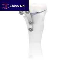 Tibia osteotomy plate TBFIXstainless steel