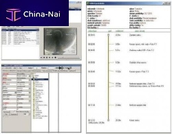 Measurement software viewerinspectionprinting