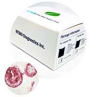 Rapid FOB test N040 seriesfor cancersoncologyfor tumor markers