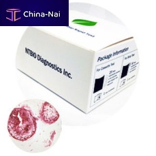 Rapid FOB test N040 seriesfor cancersoncologyfor tumor markers