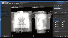 Medical imaging software MOSAIQ® 3oncologytrainingimage analysis