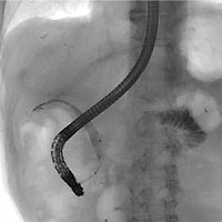 Endoscopic retrograde cholangiopancreatography software SUREengine FASTdiagnostictreatmenttraining
