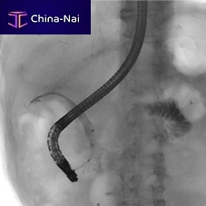 Endoscopic retrograde cholangiopancreatography software SUREengine FASTdiagnostictreatmenttraining