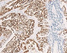 Monoclonal antibody CEM-0081polyclonal antibodyfor researchtissue