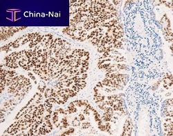 Monoclonal antibody CEM-0081polyclonal antibodyfor researchtissue
