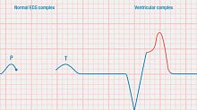 ECG simulation module heart rateanatomyweb-based