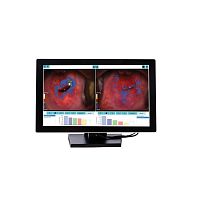 Medical software DYSISmapcolposcopyanalysismanagement