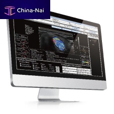 Ultrasound imaging software AmCAD-UT®image analysismanagementreporting