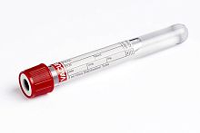 Laboratory collection tube 456161cylindricalnasopharyngealoral fluid