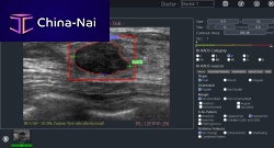 Ultrasound imaging software BU-CADimage analysisreportingdiagnostic