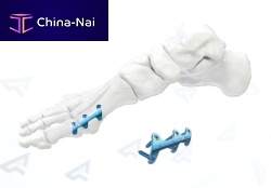 Foot phalange arthrodesis plate 400102x seriestitanium