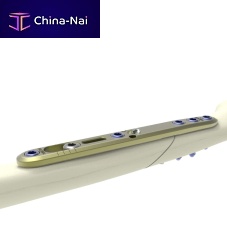 Ulna osteotomy plate HTSIS2mid-shaftlockingnon-locking