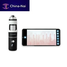 Video capillaroscope DM-110 DigiScopesmartphone-basedtablet-based