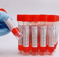 Clinical sampling kit GC4053B0 series