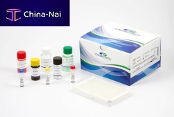 Beta-2 microglobulin reagent kit BM010Tsolutionfor researchfor cancers