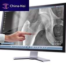 Radiology software image analysisinfection controldesign