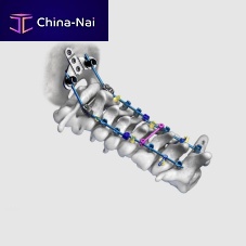 Occipito-cervical osteosynthesis unit posterioradult