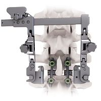Orthopedic surgery retractor CALYPSO