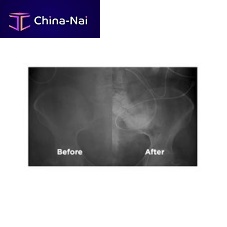 Medical imaging software 1000-925-011image enhancement