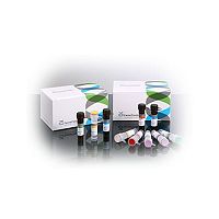 Infectious disease test kit GeneFinder for cervical canceroncologyHPV