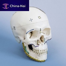 Mandible compression plate OPTIMUSlockingnon-lockingmetallic