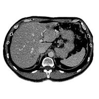 Medical software medical imagingfor researchtreatment