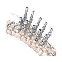 Thoraco-lumbar osteosynthesis unit RESPONSE 5.5/6.0posteriorpediatric