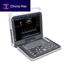 Portable ultrasound system iMage T6for gynecological and obstetric ultrasound imagingfor cardiovascular ultrasound imagingfor abdominal and pelvic ultrasound imaging