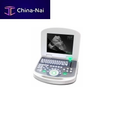 Portable ultrasound system 3W-2100for gynecological and obstetric ultrasound imagingfor cardiovascular ultrasound imagingfor urology ultrasound imaging