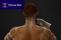Anatomy software AcuMapfor pharmaciesvisualizationtreatment