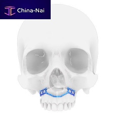 Maxilla osteotomy plate titanium