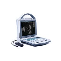 Portable ultrasound system ODU5for ophthalmic ultrasound imagingB/Wbuilt-in console