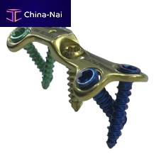 Metatarsal bone osteotomy plate HJ-VA-LOC 03forefootmediallocking