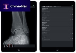 Medical imaging iOS application mOpalfor PACSvisualizationiOS