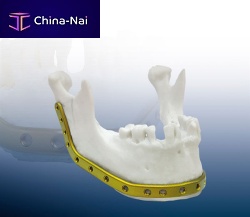 Mandible compression plate REAL FITlockingtitanium