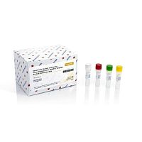 XMRV detection kit TM347 seriesfor prostate canceroncologybiological