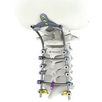 Occipito-cervico-thoracic osteosynthesis unit M.U.S.T. Miniposterioradult