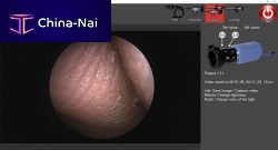 Endoscopy software for controlcapture