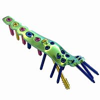 Ankle arthrodesis plate HJ-VA-LOC 02lockingtitanium