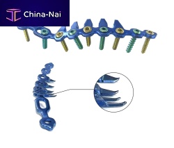 Pelvis compression plate HJ-06posterolateralposteromedialnon-locking