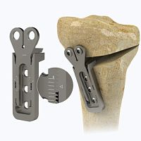 Tibia osteotomy plate 1972 Serieslocking