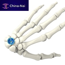 Carpal joint arthrodesis plate ARIX 2.5lockingtitanium