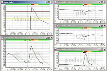 Measurement software IT SEESviewerqualityanalysis