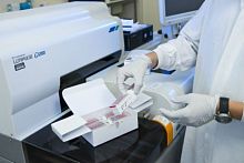 Research assay kit Lumipulse®for cancersoncologyAFP