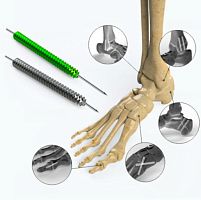 Foot compression bone screw cannulatedheadless