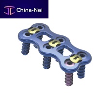 Cervical arthrodesis plate G-T652titanium